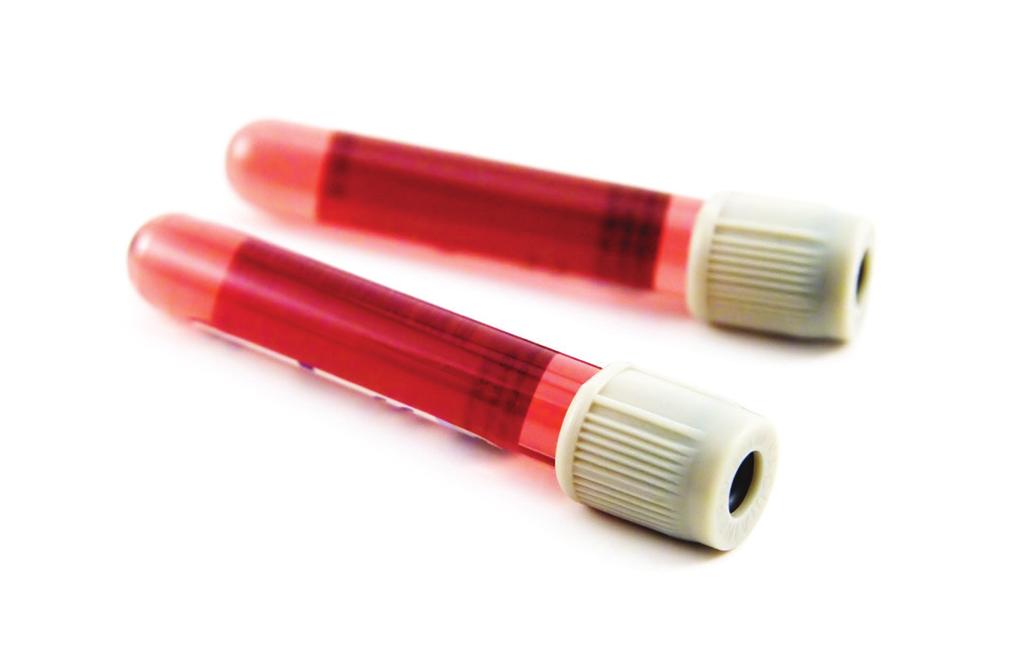 Which genomic DNA purification kit is right for your blood or serum samples?