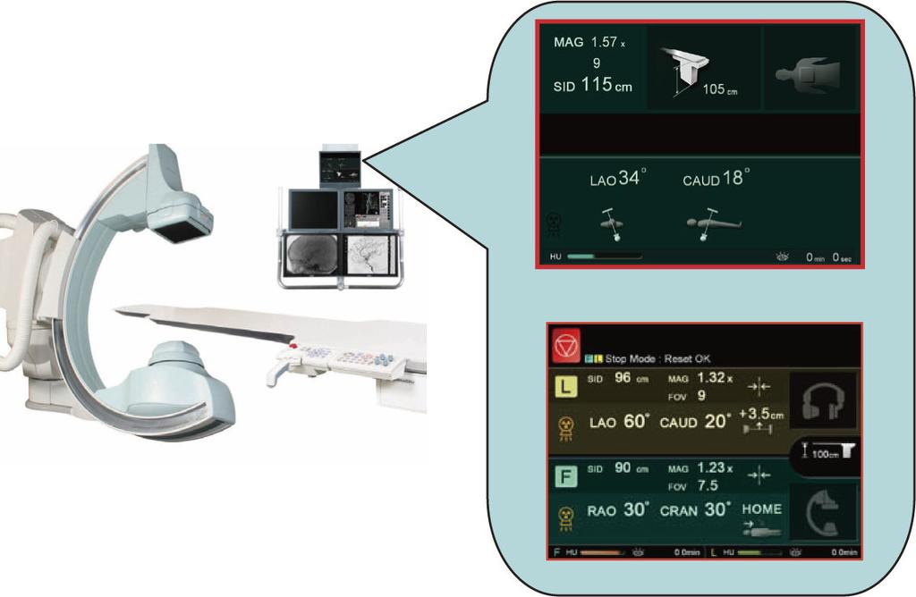 Fluoroscopy ON Live monitor Single plane Fluoroscopy OFF Dynamic Reference 2 The image changes when fluoroscopy starts. No need for the operator to switch gaze. Bi-plane Fig.