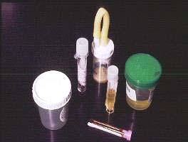 Mycobacteria Laboratory Direct Tests Specimens Detect & Isolate n = 3200/yr.
