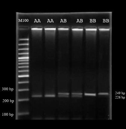 IGF-I gene and milk components 1729 RESULTS Marker genotyping and blood IGF-I level The A and B alleles of the IGF-I gene were identified based on amplification of a 249-bp fragment located in the