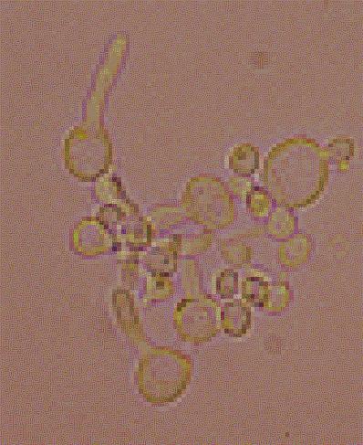 tropicalis may form pseudohyphae (usually after 3 hours incubation) which may be falsely interpreted as germ tube