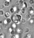 RNA) Mitochondria (MtDNA) open tubule mitochondria α granule