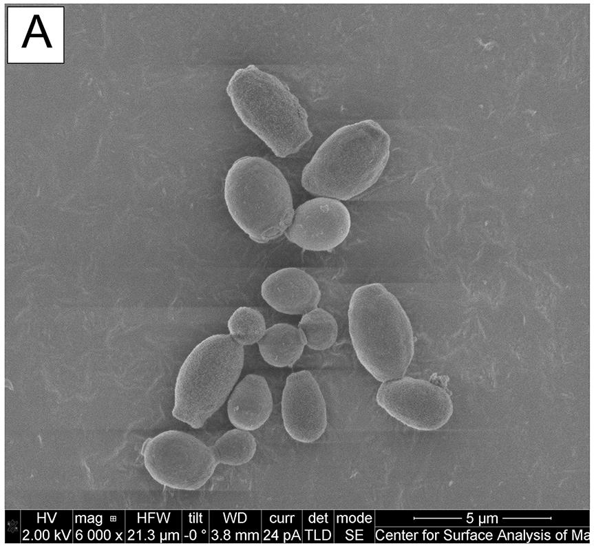 The emerging Candida auris: antifungal activity of SCY-078, a novel glucan synthesis inhibitor, on growth
