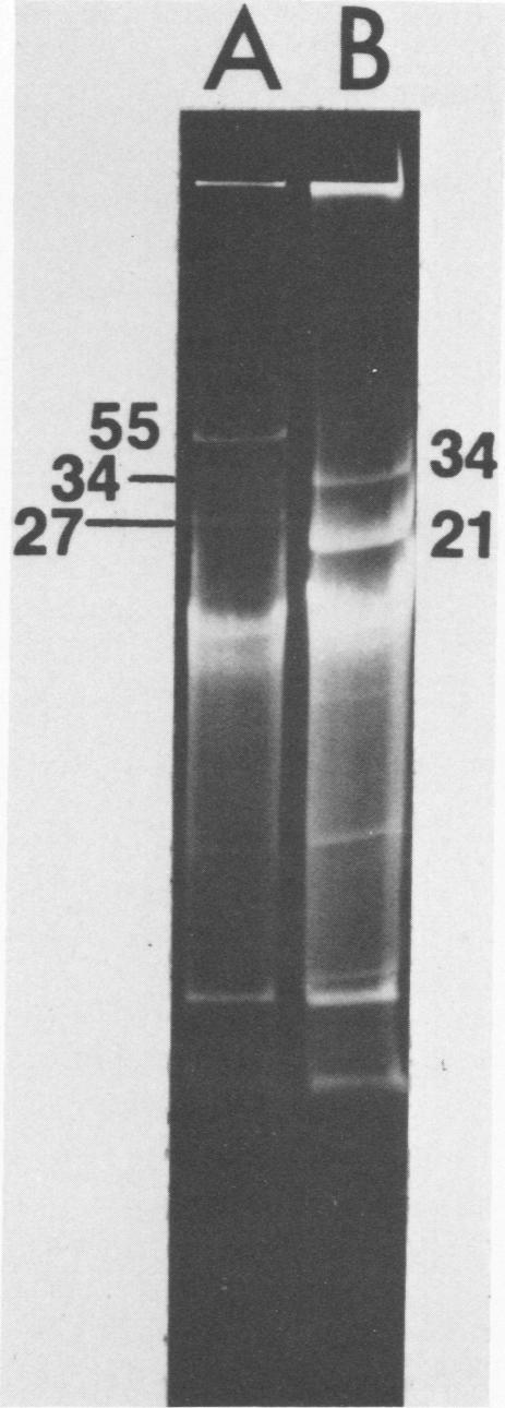 cremoris C3 demonstrating the 34- and 27-Mdalplasmids. (E) Plasmid profile of CC101 containing the 34- and 27-Mdal plasmids. (B and D) Lac' transconjugants containing both the 34- and 27-Mdalplasmids.