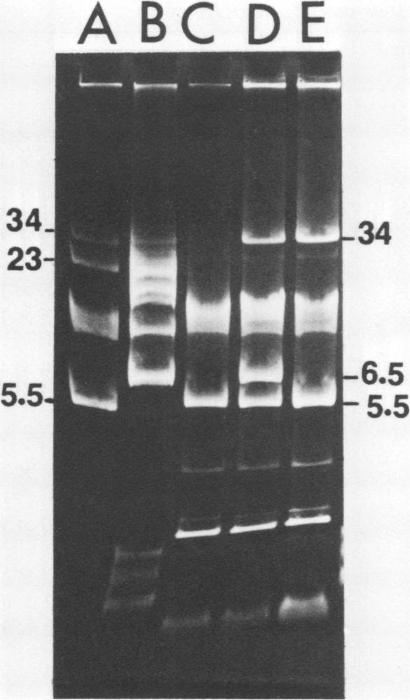 (B) CsCI-ethidium bromide-densitygradient-purified plasmid DNA from Rl containing two transmissible plasmids with sizes of 34 and 6.5 Mdal. (C) LM3302.