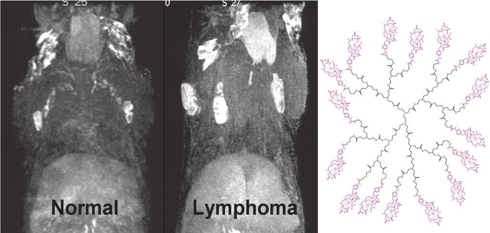 Fig. 6 MR Lymphangiogram of a normal mouse (left) compared to a IL-15 transgenic, lymphoproliferative/lymphoma mouse (right), utilizing 0.