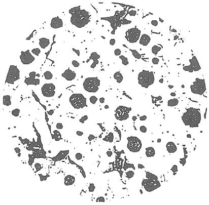 Deteriorated graphite from excessive trace elements Fig 43. 0.003% Lead (vermicular & flake) Fig 44. 0.075% Titanium (spheroids with attached flakes Fig 45. 0.05% Tellurium (vermicular graphite).