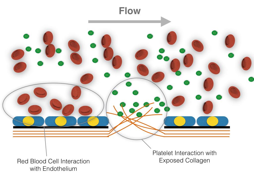 Figure 1 Interactions in thrombosis between blood cells and the vessel wall. One interaction is that between RBCs (red) and stimulated endothelial cells (blue).