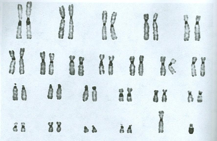 C-banded karyotype of XY cell From Miller