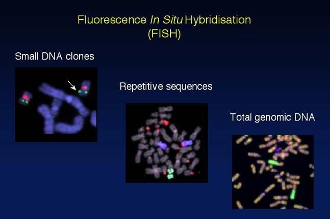 Fluorescence in situ hybridization