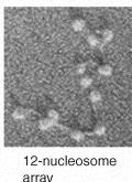 Chromatin structure 11 nm fiber Nucleosomes -147 bp DNA wound on histone core - Histones H3, H4, H2A, H2B
