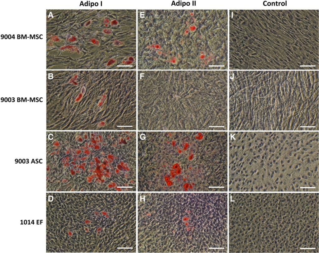 Mohamad-Fauzi et al. Journal of Animal Science and Biotechnology 2015, 6:1 Page 10 of 22 Figure 4 Oil Red O staining of MSCs and fibroblasts differentiated using two methods of adipogenic induction.