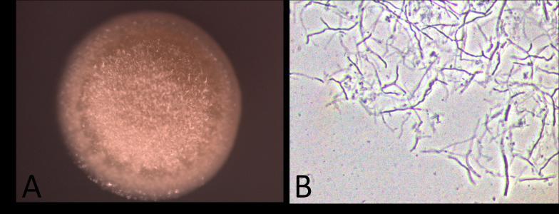 Results Twenty morphologically different Streptomyces sp. were isolated from soil and used for subsequent TLC analysis.