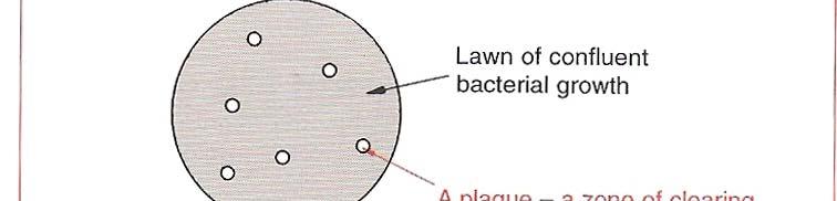 Ch 5 Introduction of DNA into Living Cells Phage DNA The basic steps in gene cloning: Bacteriophage plaques 1. Vector (Ch.