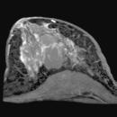 3D breast imaging. Standard with Power-class.