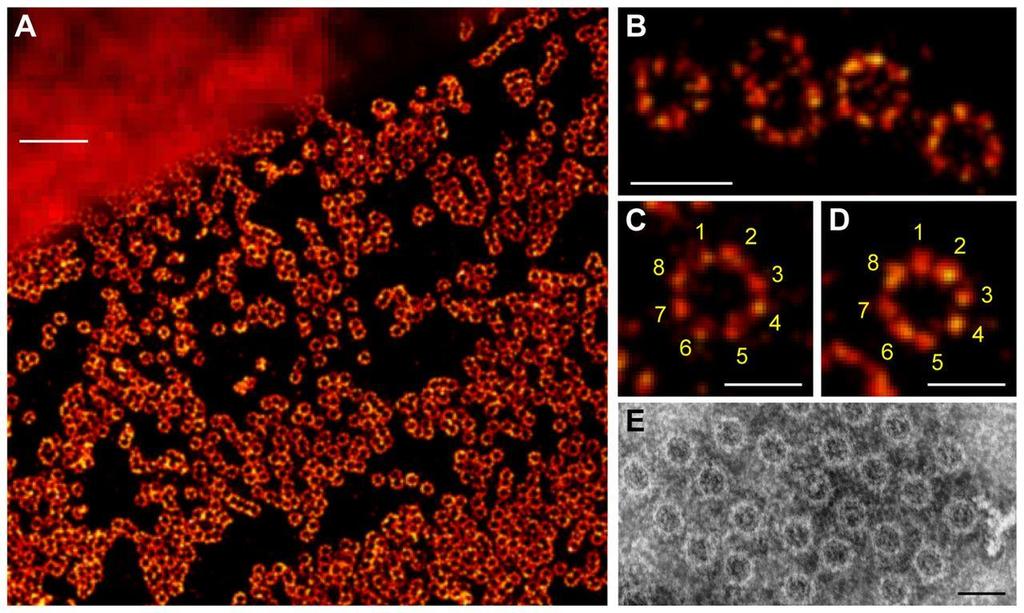 Nuclear pore complexes Fig. 1.dSTORM of the NPC integral membrane protein gp210. (A) Comparison of widefield fluorescence (upper left corner) anddstorm image (lower right corner).