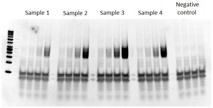 -Load the entire PCR products on a 4-20% Criterion TBE polyacrylamide gel with a DNA Ladder. -Run at 120V for 1 h (Migration of 4.5 cm). -Stain the gel in a SYBR Green bath (1/10 000, TBE 0.