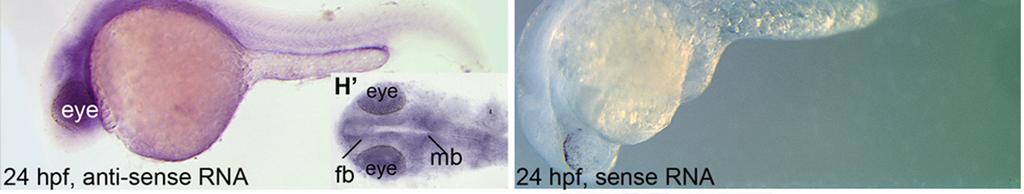 (H,H ) By 24 hpf, npc1 became mostly localized to the anterior tissues, with strong staining in the neural tissues, as