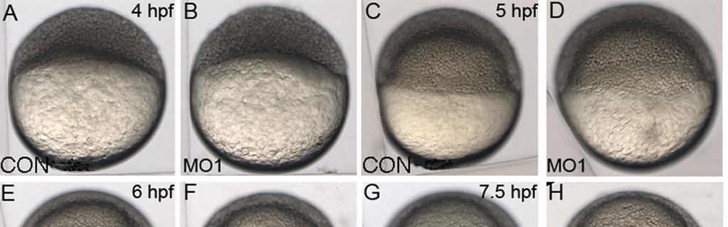Figure 3. 41 Figure 3. Reduced npc1 expression results in epiboly delay. (A-O) Lateral views of live control or MO1 injected embryos from 4-10.25 hpf.