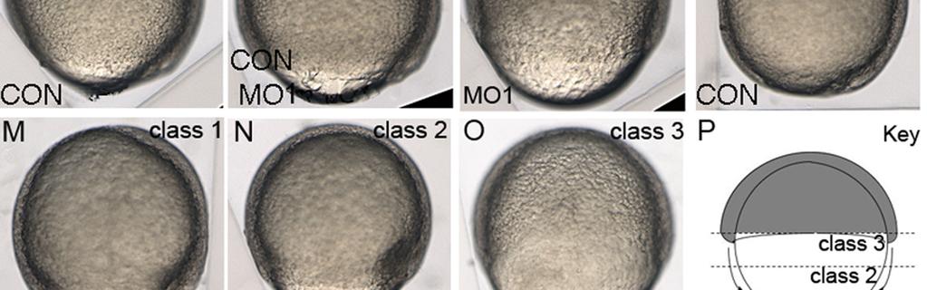25 hpf (I,J) while MO1 injected embryos were at 60 75 % epiboly (K). (L) Control embryos finished epiboly by 10.