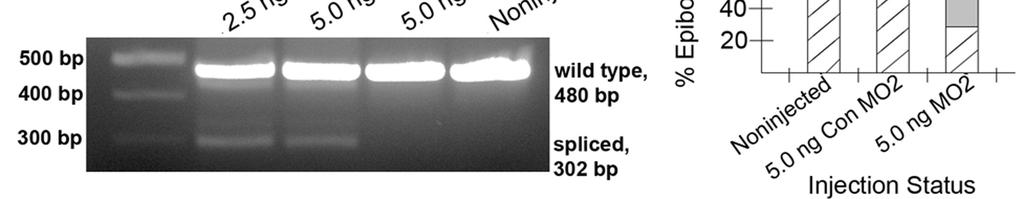 Figure 5. 43 Figure 5. SSD-expressing zygotic npc1 transcripts are essential for normal epiboly. (A) Genomic structure of zebrafish npc1. Open boxes indicate coding regions of exons.