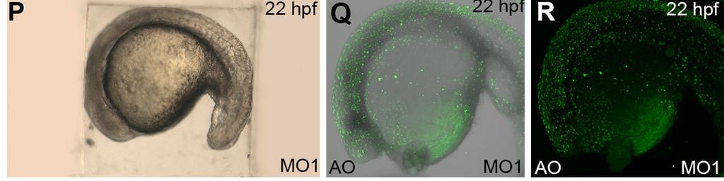(J,L) ntl stained npc1-morphants display a wider notochord at 9 somites (64+/- 5.