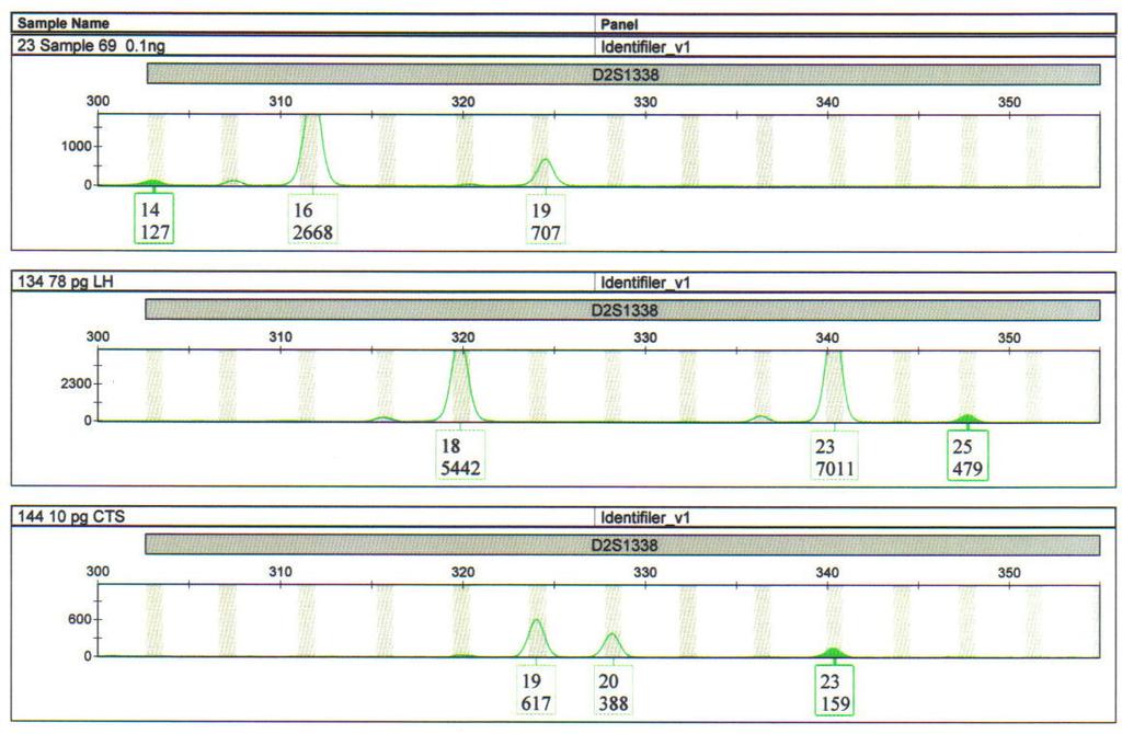 Figure 18: Allele drop-in observed at the D2S1338 locus. Drop-in alleles 14, 25 and 23 are highlighted in each panel with peak heights indicated beneath the allele call.