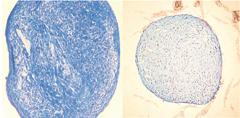 F. L. Acosta Jr., J. Lotz, and C. P. Ames Fig. 3. Photomicrographs of sections of a human MSC pellet after 3 weeks of culture.