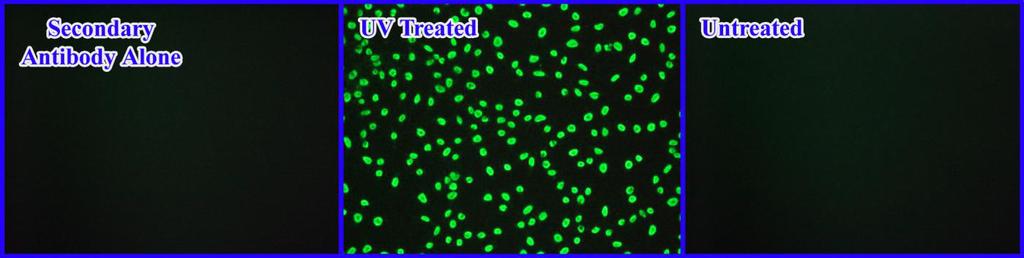 I. Cell Seeding 1. Harvest and resuspend cells in culture medium at 2-4 x 10 5 cells/ml.