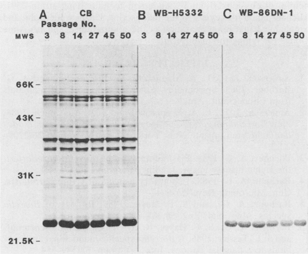 VOL. 28, 1990 LOW-MOLECULAR-WEIGHT SURFACE PROTEIN OF B. BURGDORFERI 1365 A CB B WB-H5332 C WB-86DN-1 Passage No.