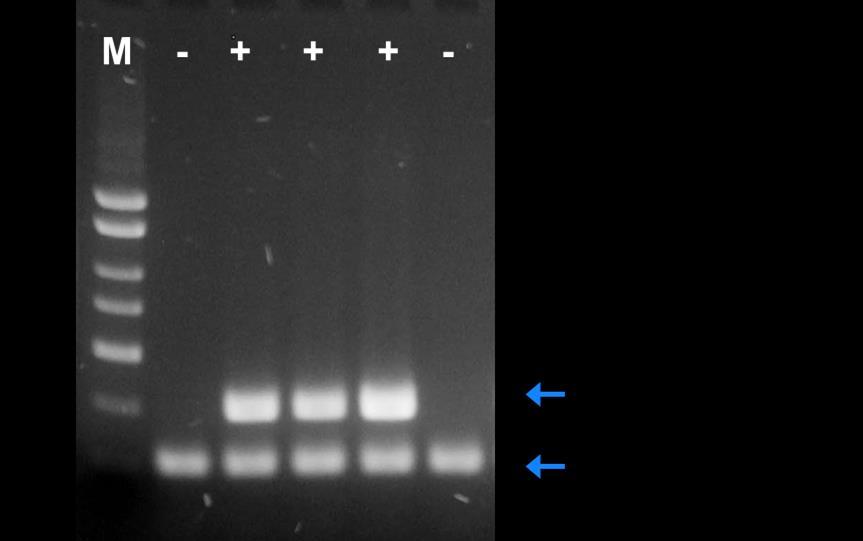 Figure 1: A representative 1X TAE, 1.4 % agarose gel showing the amplification of M. tuberculosis at different concentrations. The size of the M.