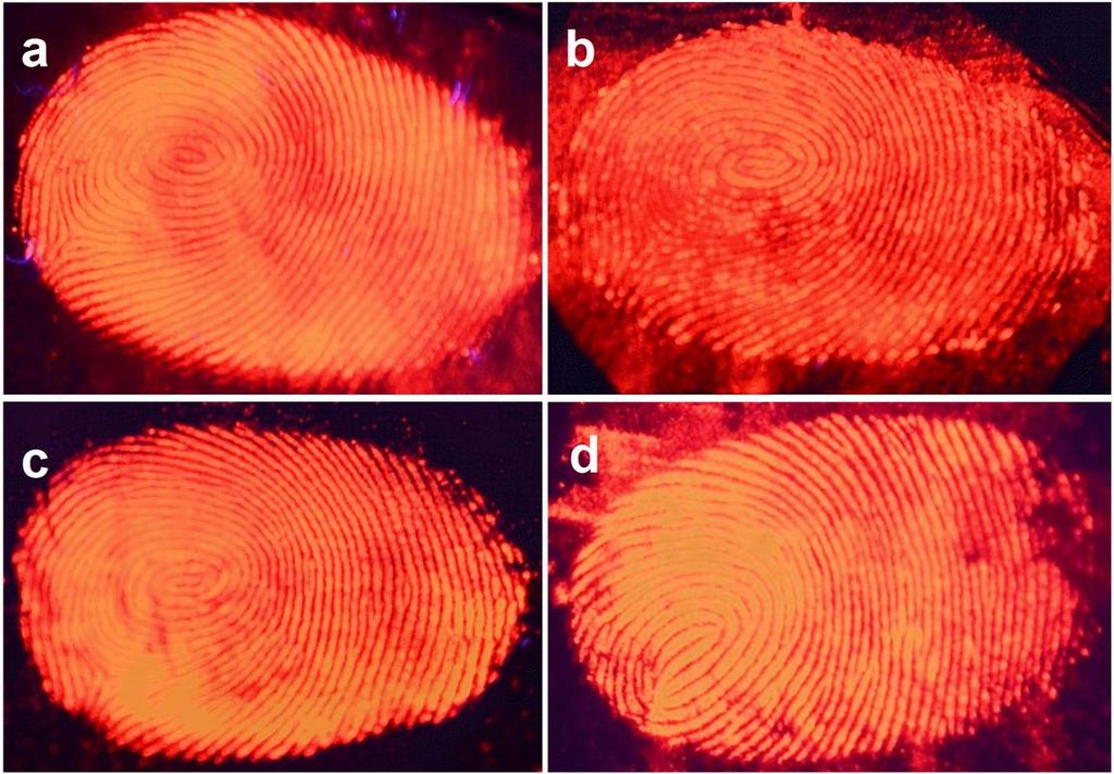 luminescence of CGZO:5Eu 3+ nanorod bundles and these bundles inhibit the background interference and provides excellent visualization of latent fingerprints. Fig.
