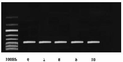 717bp molecular weight 717 bp  5 PCR