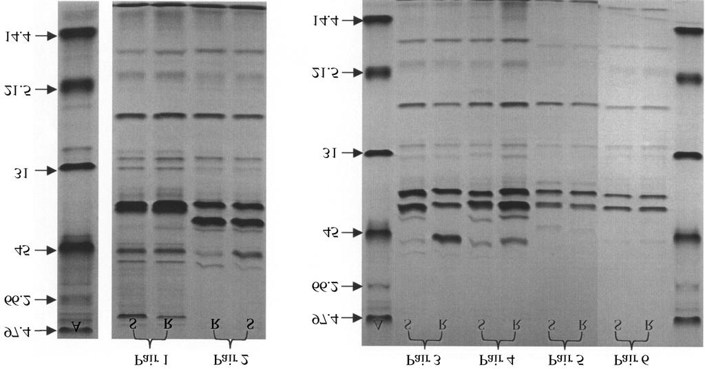 Piperacillin/tazobactam versus ESBL producers Figure 3. Outer membrane protein profiles for the piperacillin + tazobactam-susceptible (S) and -resistant (R) pairs of isolates detailed in Table 3.