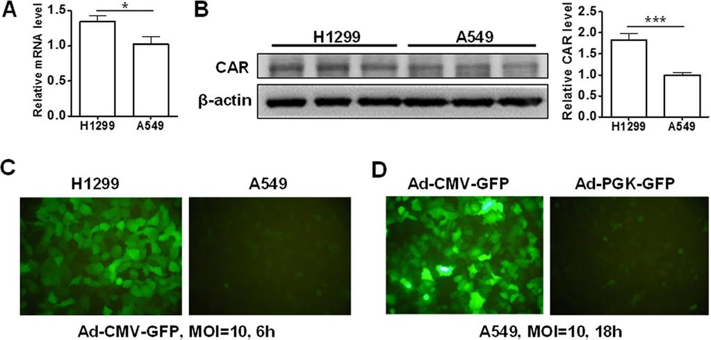 Tsai et al. Journal of Biomedical Science (205) 22:3 Page 5 of 9 Figure 4 GFP signal with Ad-CMV-GFP or Ad-PGK-GFP transduction in A549 and H299 cells.
