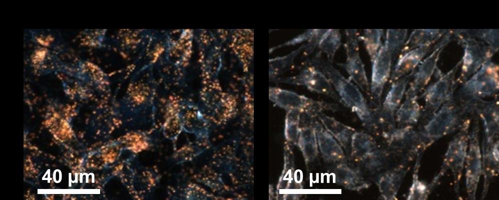 Fig. S4 Dark-field microscope images of B16 F10 cells incubated for 24 h with 5 nm of pristine SAN (a) or SANLIPO containing 5 nm of SAN (b). References S1. J. Nam, N. Won, H. Jin, H. Chung and S.