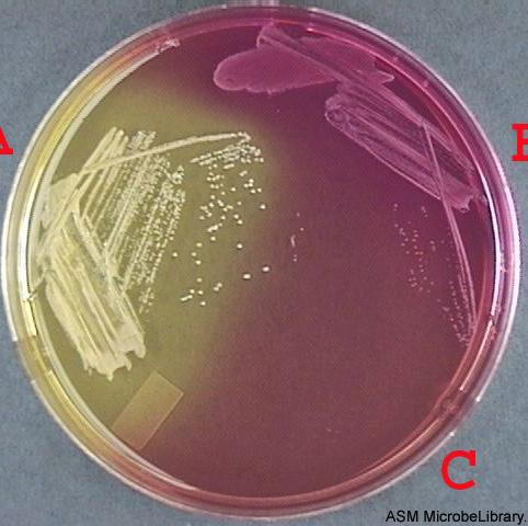 Mannitol Salt Agar (MSA) FIGURE 17. This is a selective and differential agar which contains 7.5% salt to select for certain Grampositive bacteria such as Staphylococci.