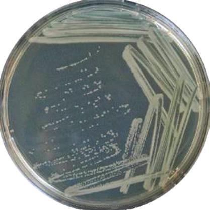 This is a selective and differential medium that allows growth of Gram-negative bacteria. The agar contains lactose and two dyes: eosin and methylene blue.