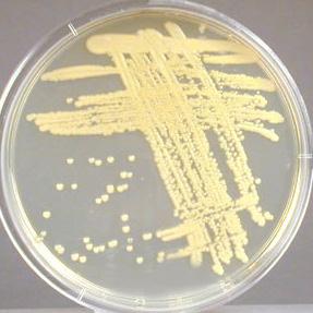 This is a selective medium containing the antibiotics colistin and nalidixic acid which selects for Gram-positive bacteria. S. aureus, S.