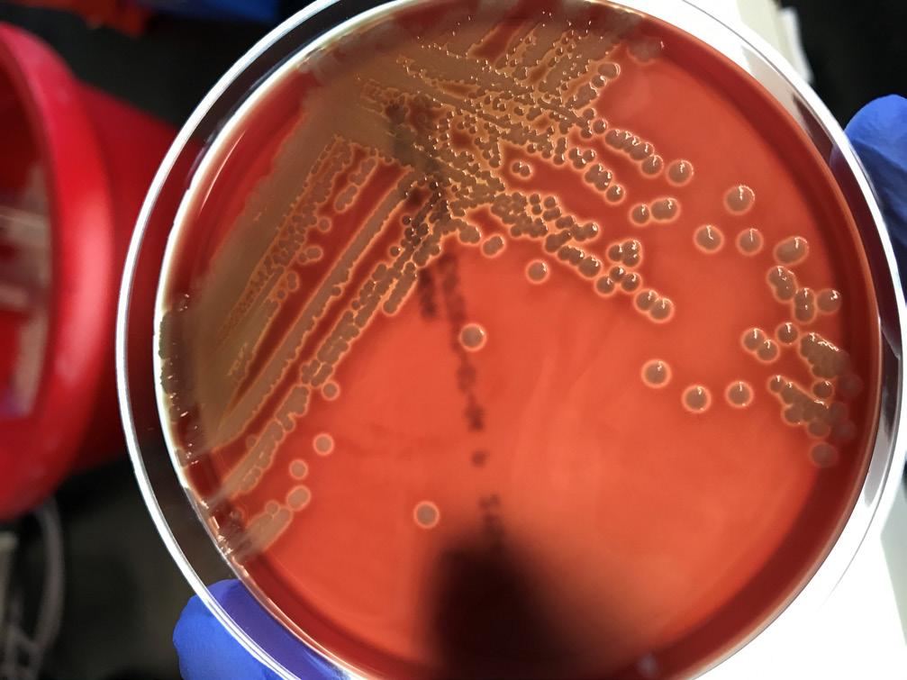 USING BLOOD AGAR TO IDENTIFY TOXIN PRODUCTION Exotoxins are toxins that are released by bacteria and can be harmful in small amounts. Blood agar can identify bacterial toxin production.