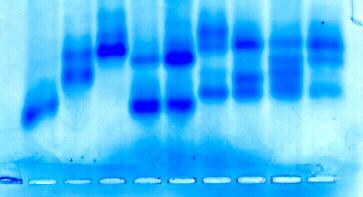 Using C4d Coated RBCs Use sucrose method and fresh serum to add more C4 antigen to RBCs Group O, can be stored frozen in LN 2 Kraemer K,