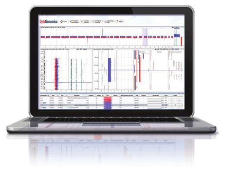 solution comprised of reagents, instruments and software that enables accurate detection of genomic aberrations.