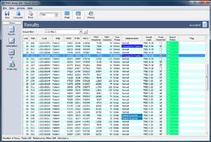 EnLite Workstation software includes Plate view of