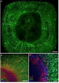 cells Axon ingrowth and synapse formation on