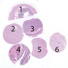 Assessment Run 45 205 Epithelial cell-cell adhesion molecule (Ep-CAM) Material The slide to be stained for Ep-CAM comprised:. Appendix, 2. Kidney, 3. Basal cell carcinoma, 4.