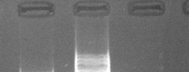 HLA-A*01 PCR-SSP