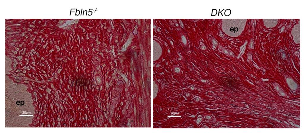 Figure S6. DKO vaginal tissues contain more collagen fibers compared to Fbln5 -/- mice.