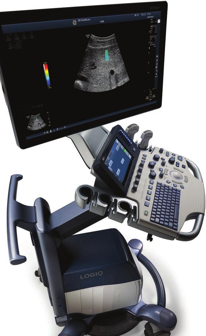 NOW PART OF THE XDCLEAR FAMILY The LOGIQ S8 has been enhanced with XDclear imaging architecture and probe technology.
