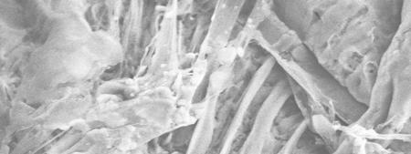 Silk fibroin gel has potential for being another