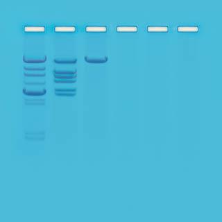 Complete Activity- Restriction Enzyme Cleavage of DNA (EDVOTEK 112) Complete Procedure steps 1-6 (p.